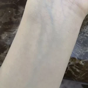Pintura de Veines sobre la Integridad del Cuerpo
